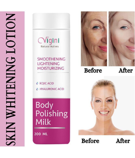 Vigini 100% Natural Active Skin Lightening Whitening Body Polishing Milk Lotion With Kojic & Hyaluronic Acid, UnderArms Under Arms Brightening Cream, Removes / Removal D-Tan Pigmentation Dar