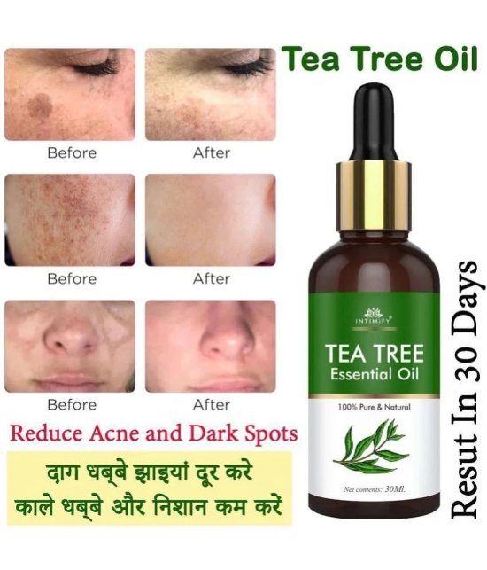 Intimify Tea Tree Essential Oil, Anti Acne Face Oil, Anti Ageing Face Oil, 30 Ml