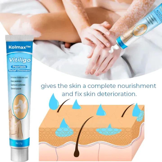 Kolmax™ Vitiligo Soothing Ointment ?Flash Sale?-3 PC'S @ Rs 599