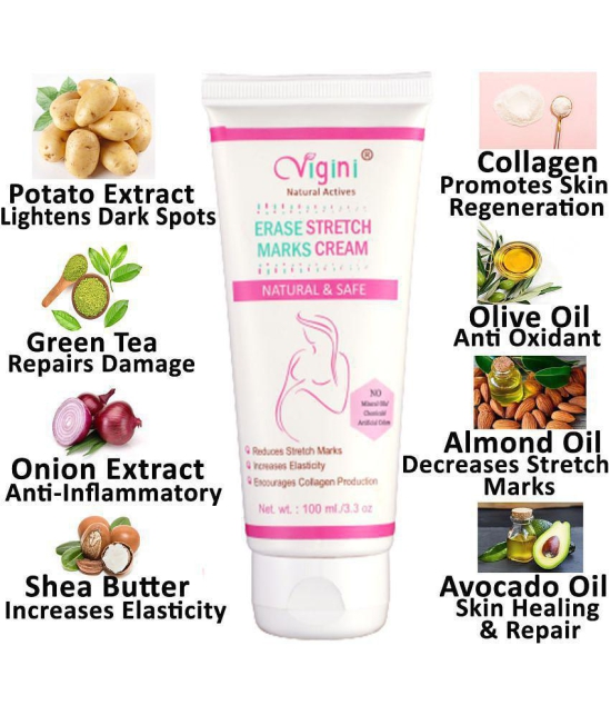 Vigini Natural Stretch Marks Removal Cream for Skin Tightening Shaping & Firming Cream 100 g