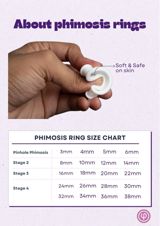 Phimosis Stretching Rings Set – 20-Piece Pain-Free Solution for Gentle Skin Stretching | Safe, Non-Invasive Treatment at Home