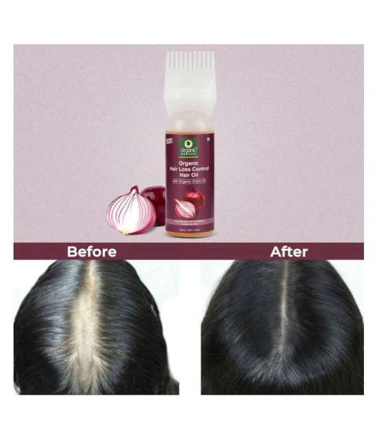 Organic Harvest Onion Hair Oil for Hair Growth, Reduces Hairfall, Control Hair Loss, With Red Onion Extracts - 150ml