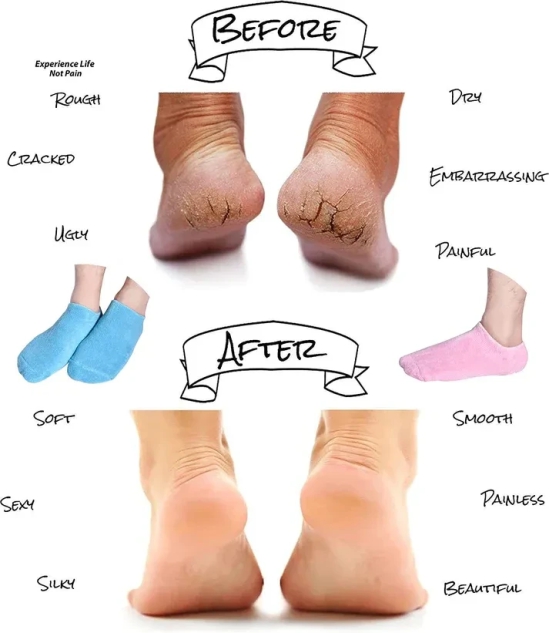 Crack Heel Silicon Spa Gel Socks-BUY 2 GET 2 FREE