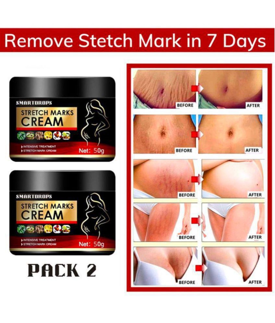 Smartdrops Pragnancy Stretch Mark Remove Cream Shaping & Firming Cream 50 g - Pack of 2