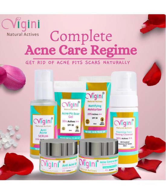 VIGINI Anti Acne Oil Free Gel Face Moisturizing for Acne Prone Skin-50gm