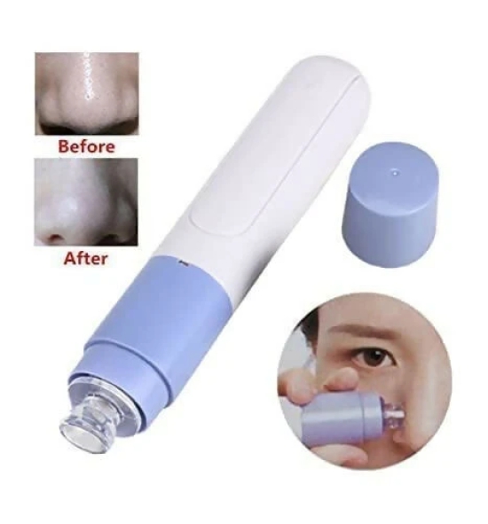 Blackhead Remover – Pore Vacuum Tool for Clear, Smooth Skin