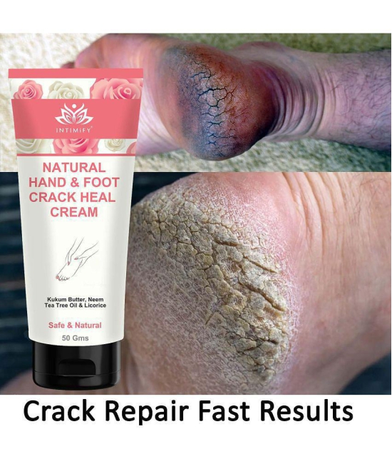 Intimify Heel Crack Cream, Foot Cream Cracking Cream, Foot Crack Foot Cream ( 50 g )