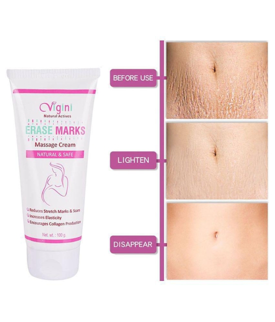 Vigini Natural Stretch Marks Removal Cream for Skin Tightening Shaping & Firming Cream 100 g