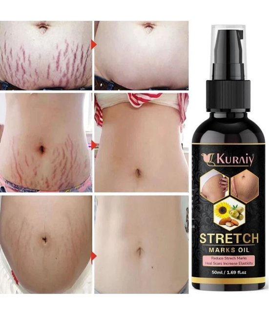 Kuraiy stretch Oil for Stretch Marks Removal Post Pregnancy stretch mark cream oil (50 ml)