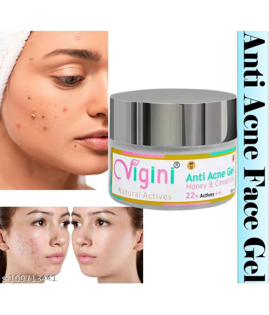 VIGINI ANTI ACNE FACE GEL FOR PIMPLES CONTROL SCARS REMOVAL WITH HONEY CINNAMON, NIACINAMIDE FACE SERUM SPF 15-50GM