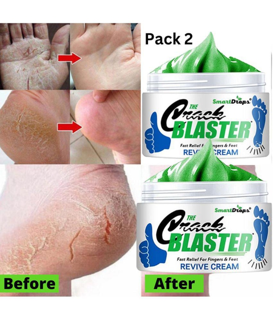 Smartdrops Chapped Hand And Foot Cream Crack Peeling Repair Anti Dry Skin Remove Dead Skin Foot Moisturizing (50gm) (For Women and men) Pack of 2