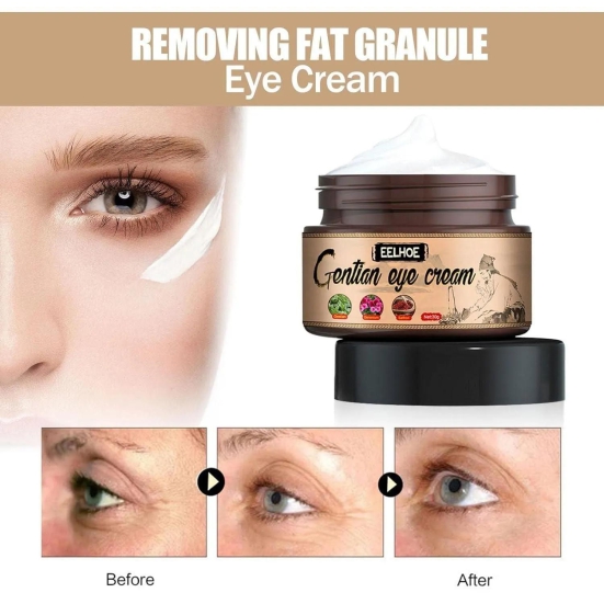 Gentle Eye Cream For Eye Bags Puffiness Wrinkles Removal