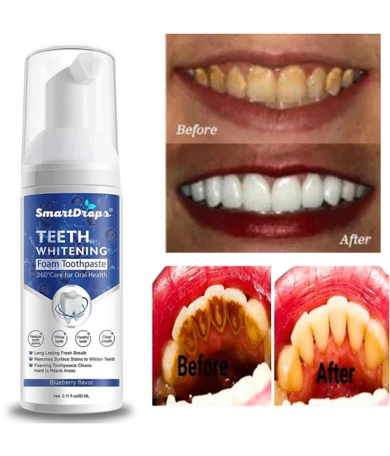 Smartdrops Dentist Recommended Denture Oral Kit